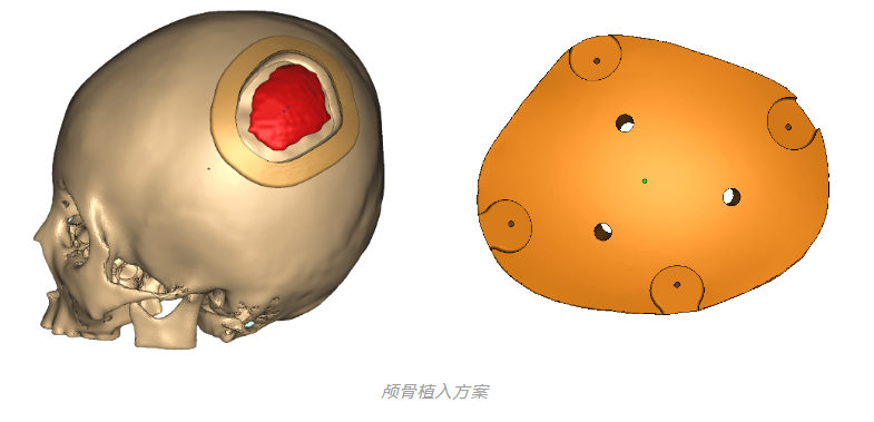 3D打印機(jī)